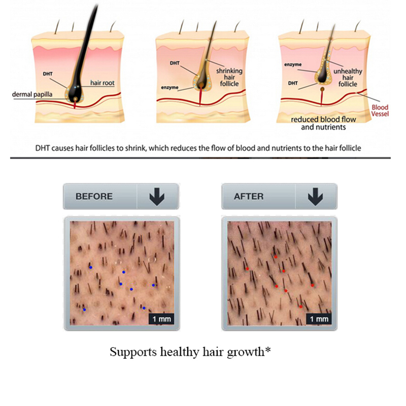 PURC Ginger Hair Loss Shampoo  - Licorice Root Sticks review and price