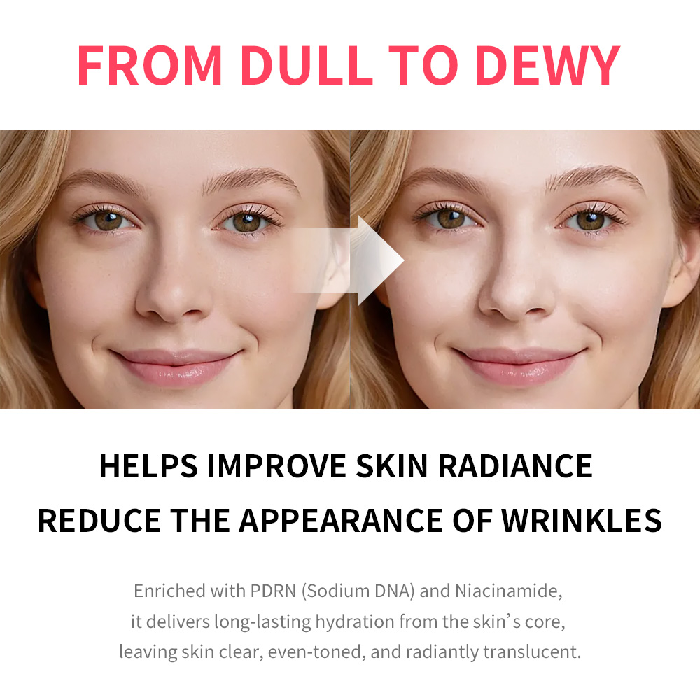 PDRN Pink Niacinamide Milky To - Echinacea review and price